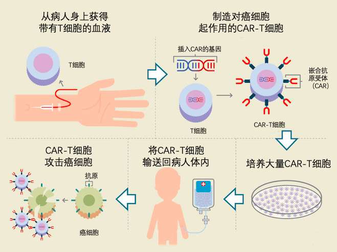 car-t